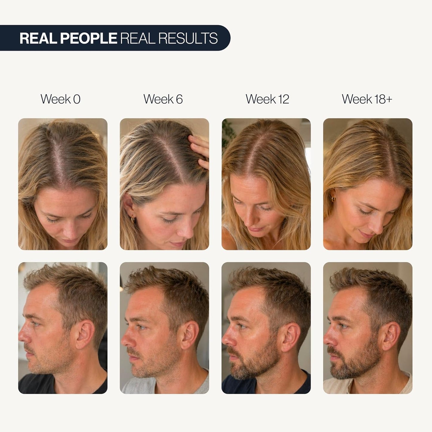 Advanced Hair Growth Serum（Two bottles）
