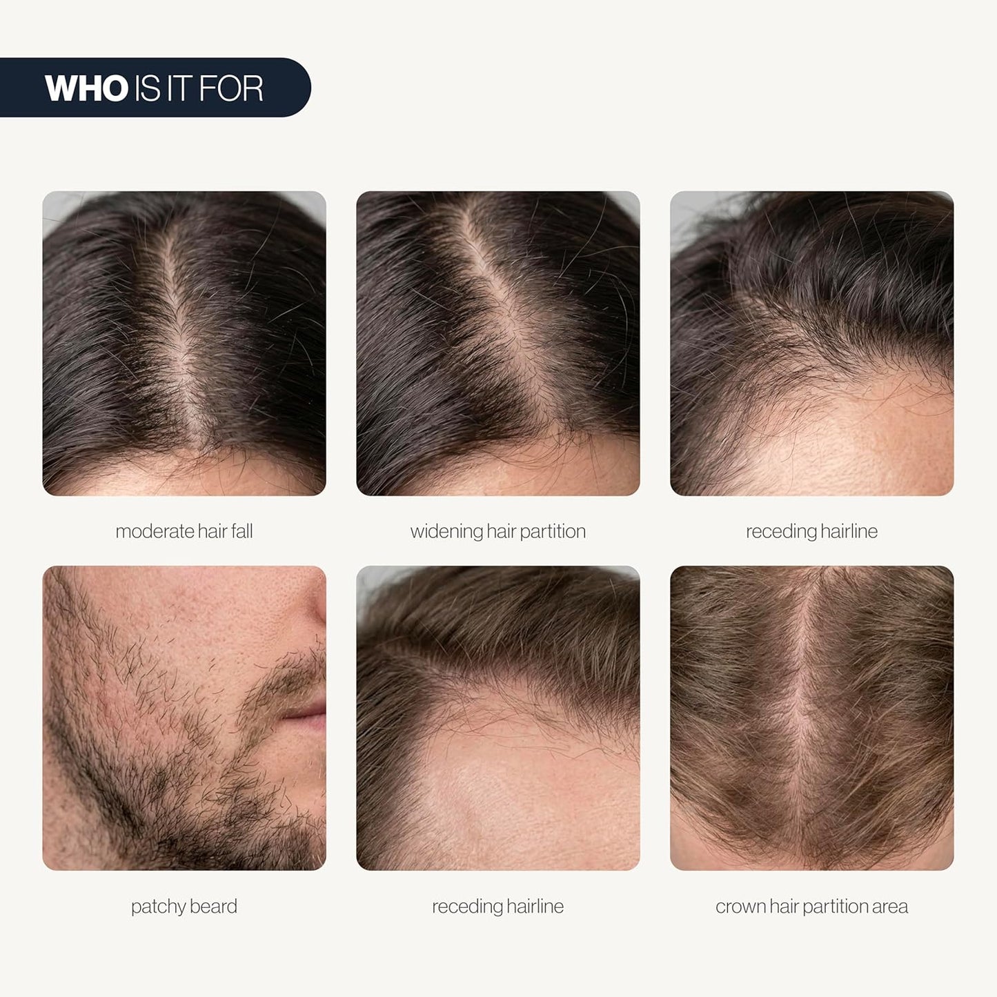 Advanced Hair Growth Serum（Two bottles）